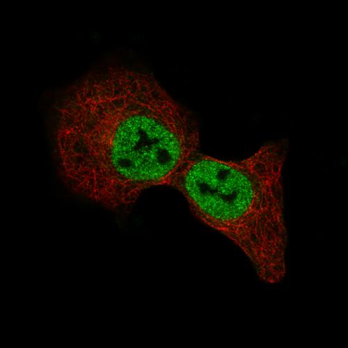 Immunofluorescence staining of A549 cell