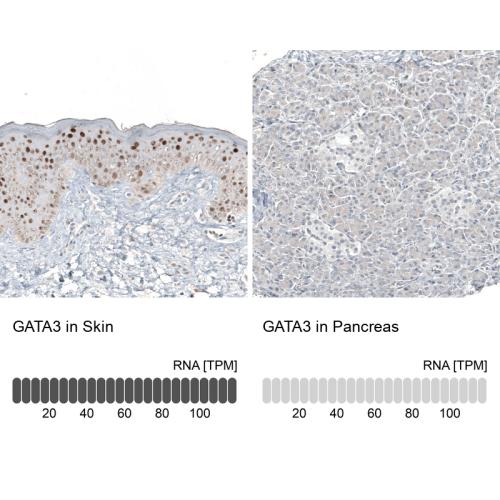Immunohistochemistry analysis in human s