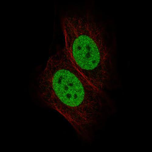 Immunofluorescence staining of MCF7 cell