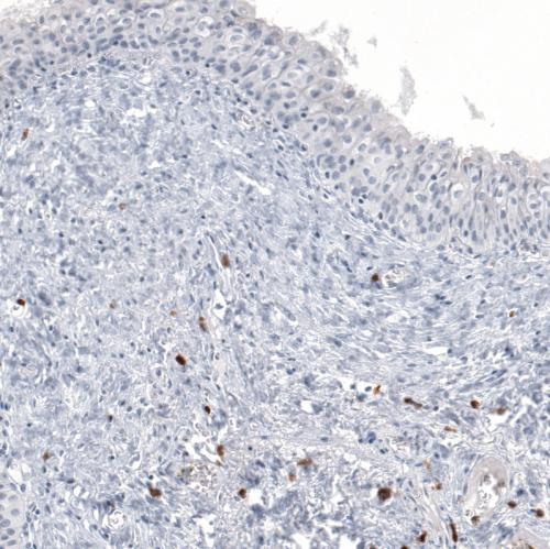 Immunohistochemical staining of human ur