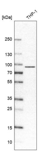 Western blot analysis in human cell line