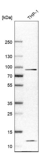 Western blot analysis in human cell line