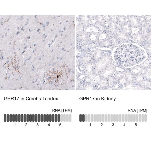 Immunohistochemistry analysis in human c