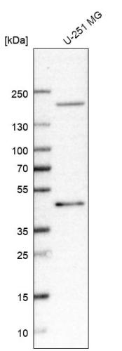 Western blot analysis in human cell line