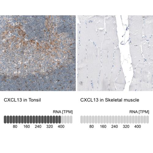 Immunohistochemistry analysis in human t