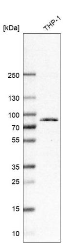 Western blot analysis in human cell line