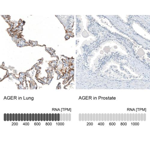 Immunohistochemistry analysis in human l