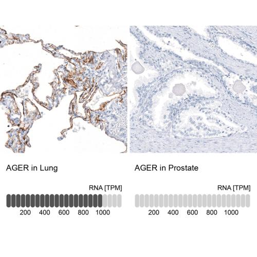 Immunohistochemistry analysis in human l