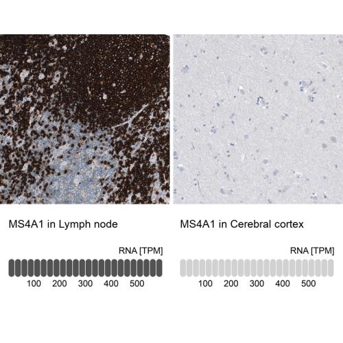 Immunohistochemistry analysis in human l