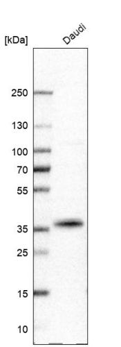 Western blot analysis in human cell line