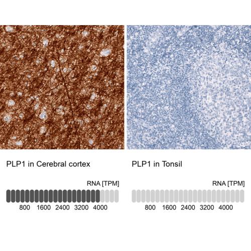 Immunohistochemistry analysis in human c