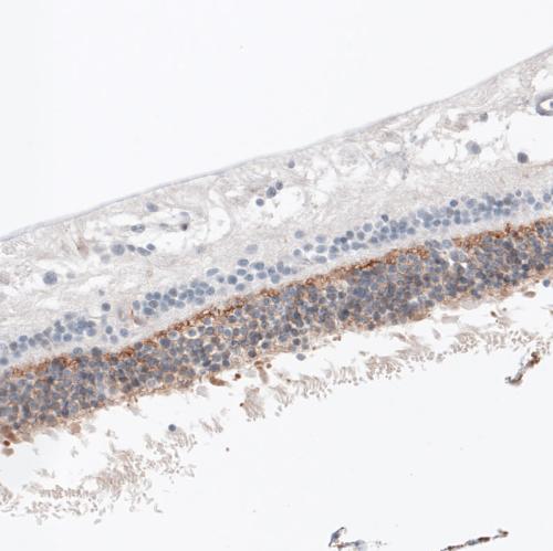 Immunohistochemical staining of human re