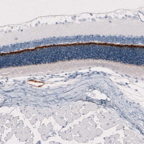 Immunohistochemical staining of rat eye 