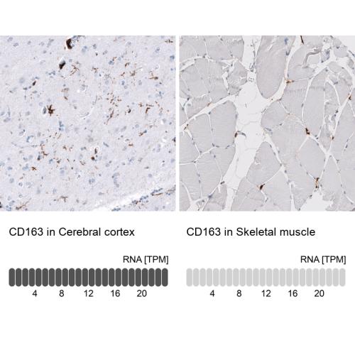 Immunohistochemistry analysis in human c