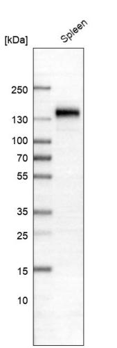 Western blot analysis in human spleen ti