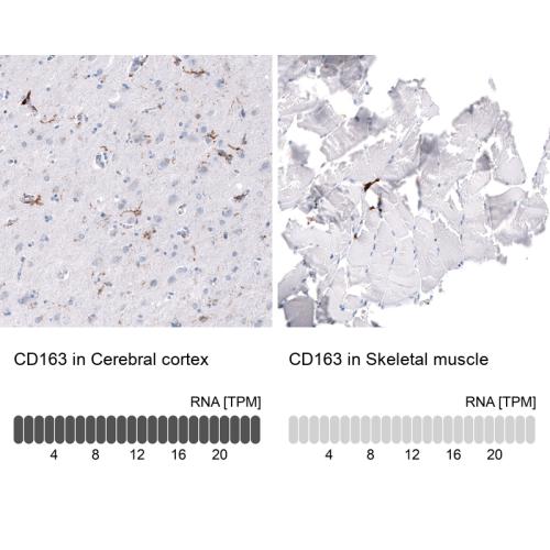 Immunohistochemistry analysis in human c