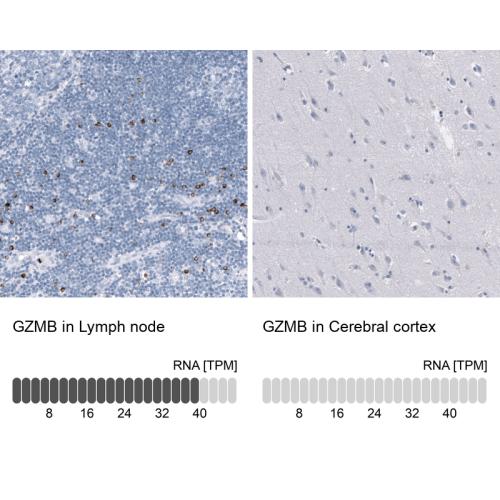 Immunohistochemistry analysis in human l