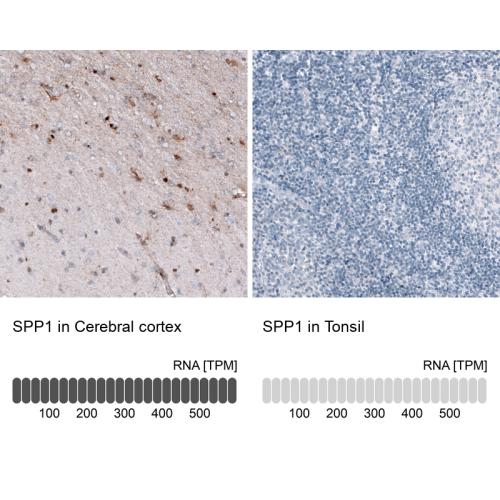 Immunohistochemistry analysis in human c