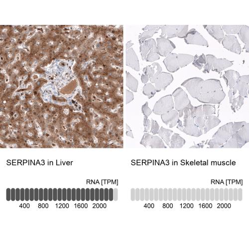 Immunohistochemistry analysis in human l
