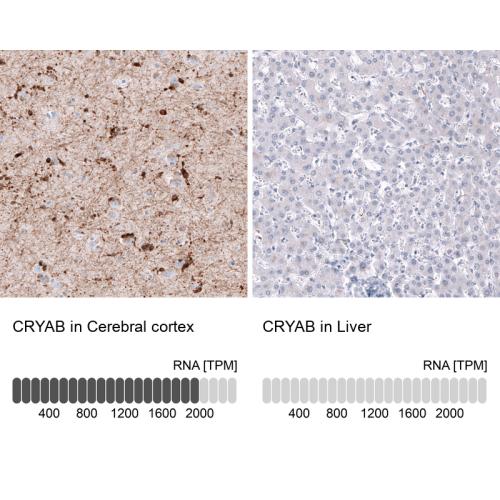 Immunohistochemistry analysis in human c