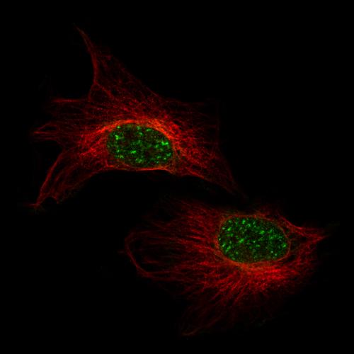 Immunofluorescence staining of U-138 MG 
