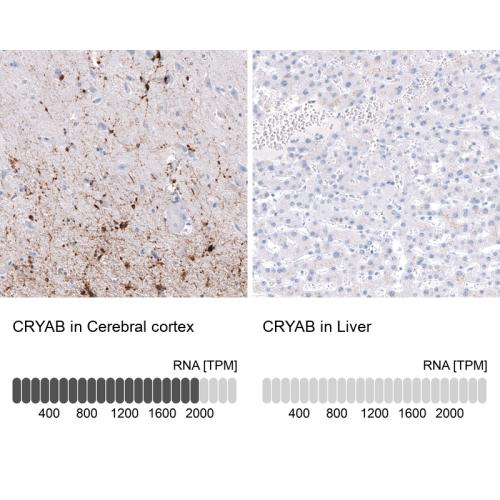Immunohistochemistry analysis in human c