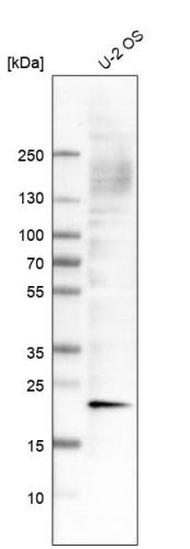 Western blot analysis in human cell line