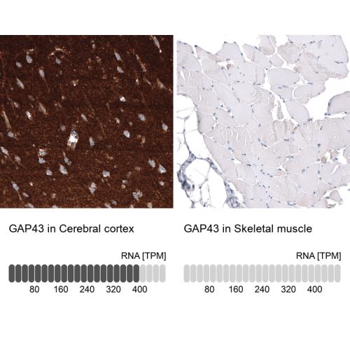 Immunohistochemistry analysis in human c