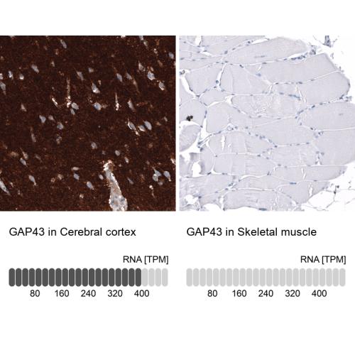 Immunohistochemistry analysis in human c