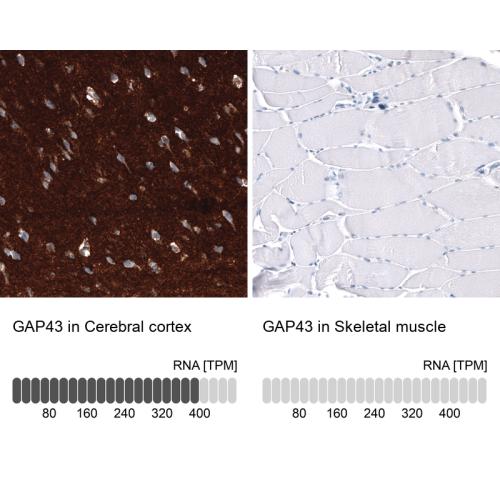 Immunohistochemistry analysis in human c