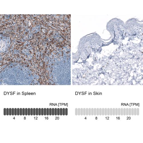Immunohistochemistry analysis in human s