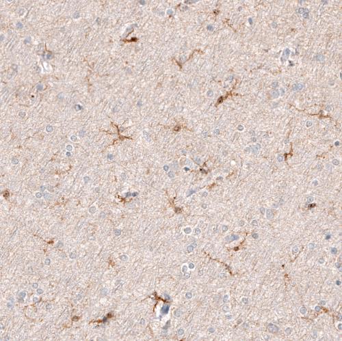 Immunohistochemical staining of human ce