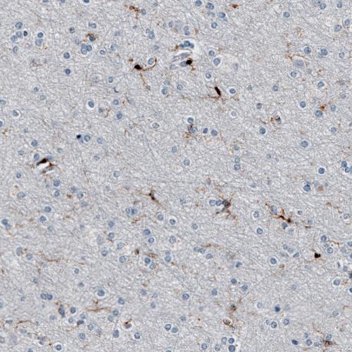 Immunohistochemical staining of human ce