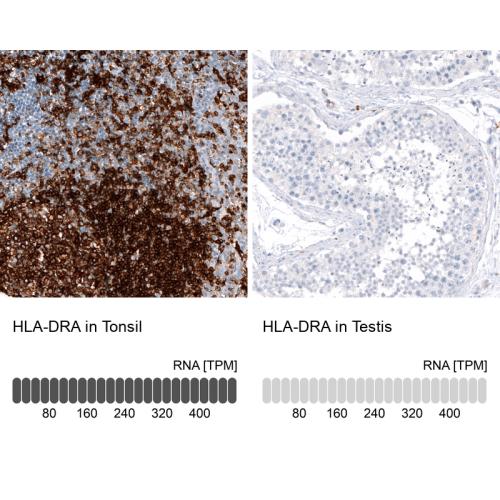 Immunohistochemistry analysis in human t