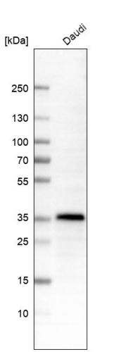 Western blot analysis in human cell line