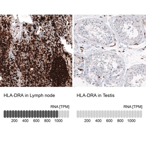 Immunohistochemistry analysis in human l