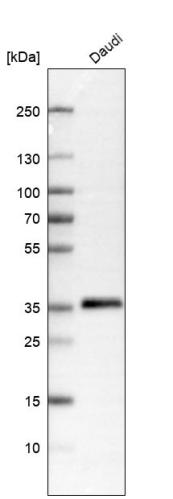 Western blot analysis in human cell line