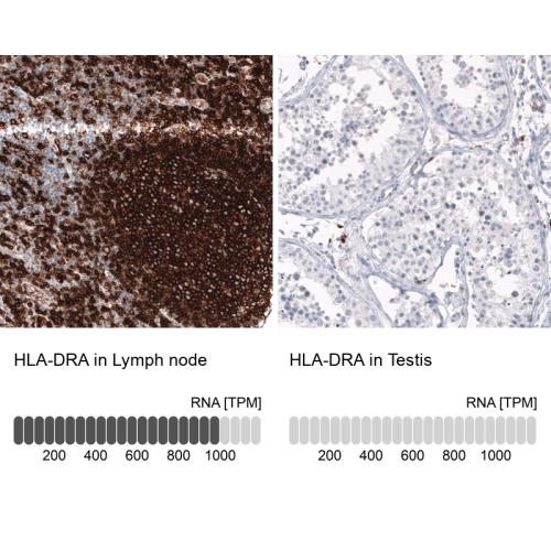 Immunohistochemistry analysis in human l
