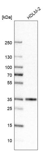 Western blot analysis in human cell line