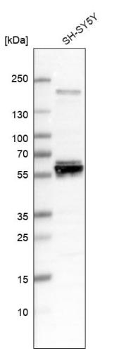 Western blot analysis in human cell line