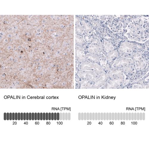 Immunohistochemistry analysis in human c