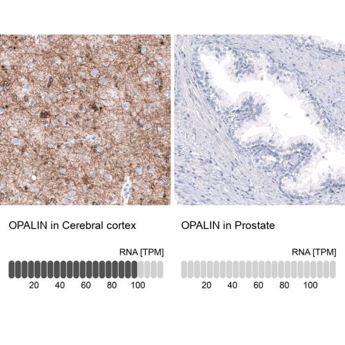Immunohistochemistry analysis in human c