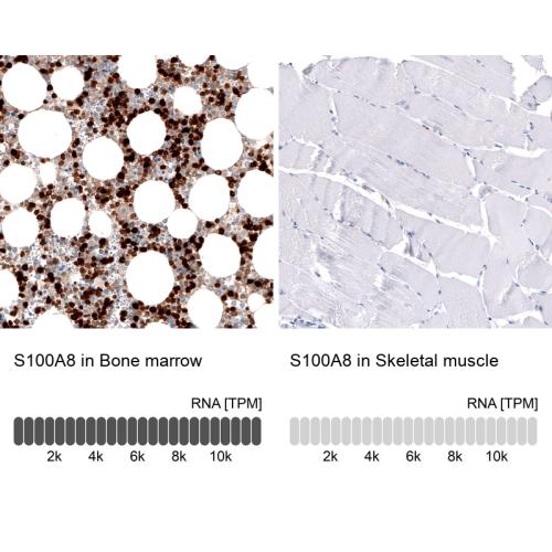 Immunohistochemistry analysis in human b