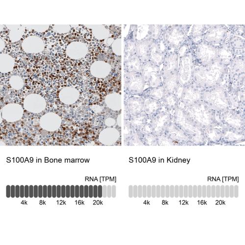 Immunohistochemistry analysis in human b