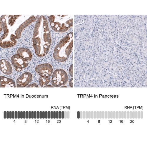 Immunohistochemistry analysis in human d