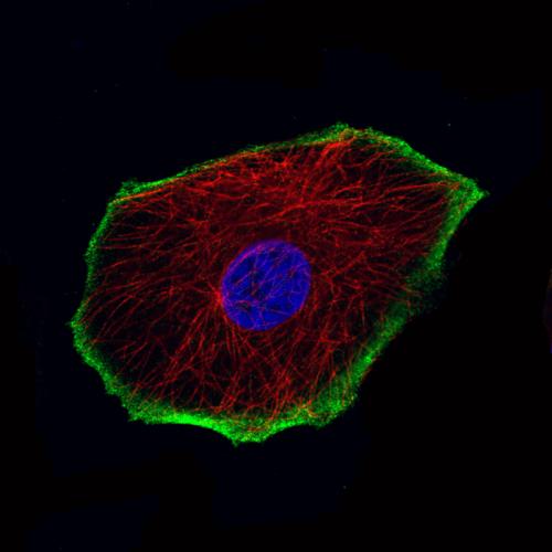 Immunofluorescence staining of MCF7 cell
