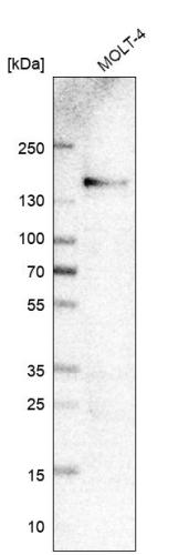 Western blot analysis in human cell line