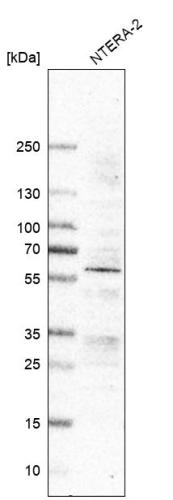 Western blot analysis in human cell line