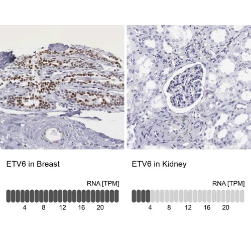 Immunohistochemistry analysis in human b