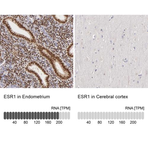 Immunohistochemistry analysis in human e